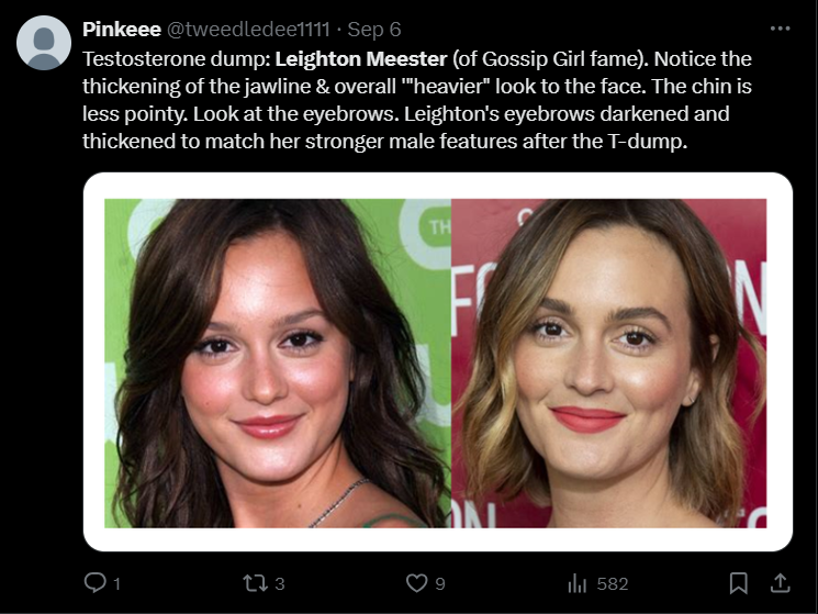 The contrast of the appearance of Leighton Meester